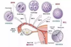 试管婴儿的流程是怎么样的？