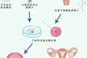 做试管婴儿详细步骤是怎么样的?