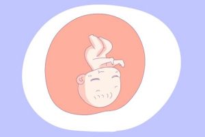 为什么要做试管婴儿检查ca125？