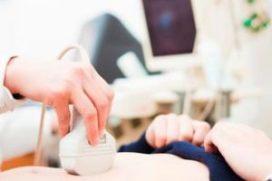女性不孕检查项目及流程指南，附佳检查时间解析