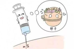 试管婴儿抗结剂方案优势是什么