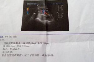 做试管婴儿成功“好孕”，我用的是长方案