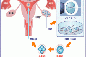 试管婴儿促排卵对身体有伤害吗？