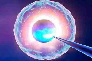 做试管婴儿取卵后肚子大是什么原因？