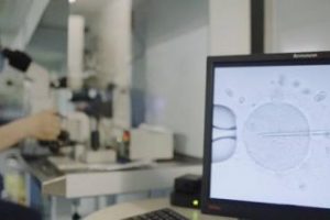 刚做完人工授精需要注意什么？医院做人工授精流程有哪些？