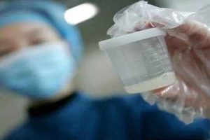 试管婴儿取精少会重取吗？