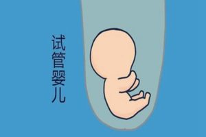 试管婴儿取精要多少天禁欲？