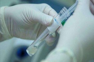 试管婴儿方怎么取精