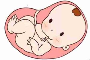 试管婴儿移植后需要保胎吗？