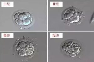 试管婴儿级别3BB代表什么意思？