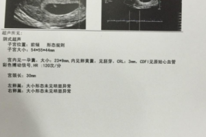 染色体异常做试管婴儿，胚胎成功着床我怀孕了！