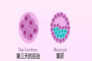 试管婴儿鲜胚着床失败的原因有哪些？