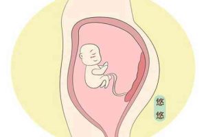 试管婴儿如何着床在子宫前壁？