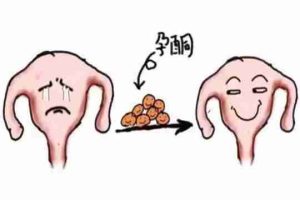 做试管婴儿移植后孕酮过高该怎么办