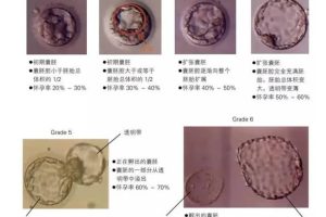 少精弱精做试管，成功率怎么样？