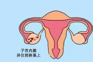 老公少精弱精怎么调理身体