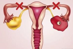 佛山单身女人可以做试管婴儿吗