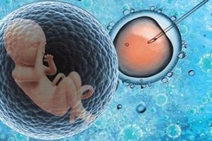 女性卵巢早衰的症状？女性有先天不孕不育的症状是什么？女性卵巢早衰还能做中山试管吗？