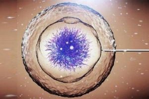 不孕女性高血糖在汕头试管医治中该如何掌握