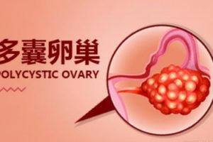 久备不孕糖尿病患者适不适合深圳试管婴儿辅助生育