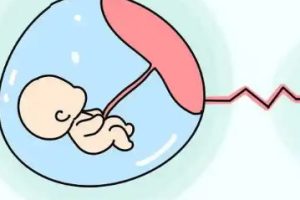 不孕不育·一起理解关于试管婴儿周期医治的几个误区