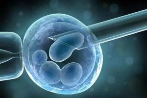 多年不孕的排卵障碍患者适合惠州试管婴儿医治指征吗
