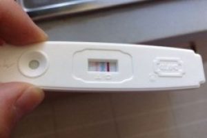试管婴儿技术简介，公立试管婴儿医院对比私立生殖中心，济南公立试管婴儿医院的诊疗流程