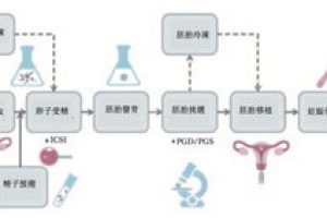 抗结剂方案促排卵的流程，不同人群应用拮抗剂方案的情况？