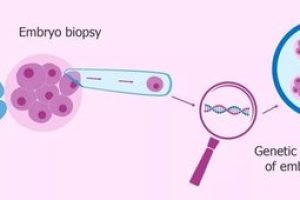 试管婴儿移植后，怎样做能帮助胚胎着床？