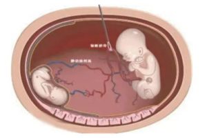 试管婴儿前的身体调理，男女双方都要重视！