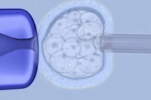 染色体平衡易位，还能拥有健康的孩子吗？