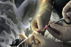 试管过程中为什么要进行宫腔镜检查