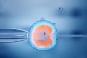 多囊患者卵泡为何不成熟影响珠海试管婴儿医治吗