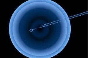 试管医治取卵环节的相干疑问通常都有哪些