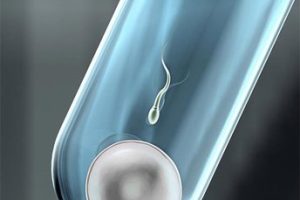 试管婴儿医治需要如何做成功率才能翻倍