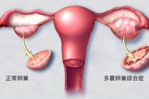 深圳试管医治是做的次数越多成功几率越大吗