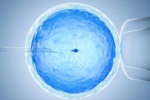 男性不育又有畸精症佛山试管婴儿医治能成功吗