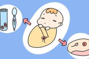 宫腔粘连手术之后预备中山试管婴儿医治要注意什么吗