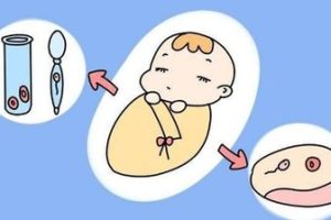 男性患有精索静脉曲张可以医治吗?久备难育可以考虑珠海试管婴儿吗