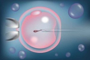 子宫腺肌症会不会影响怀孕可以做珠海试管婴儿吗