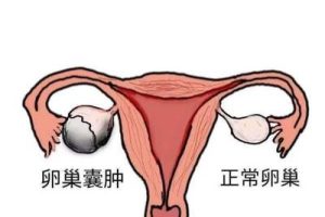 40岁以上女性流产率会增高，备孕吃辅酶Q10可降低几率