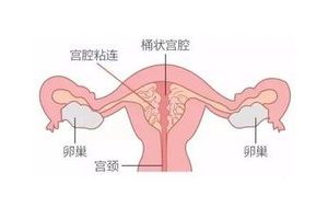 女性备孕服用定坤丹益处多！帮助受精卵着床非难事
