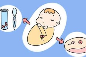 孕妇发烧别盲目吃布洛芬，用什么退烧药要遵循原则
