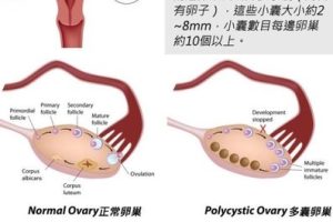 做试管婴儿“打针”环节有哪些?疼不疼?