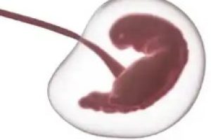 揭阳试管婴儿＂太难了＂！哪些人做更容易成功？