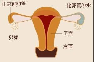 取卵后，怎样保养卵巢？
