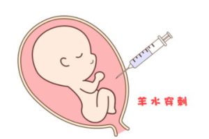 排卵监测什么时候做？