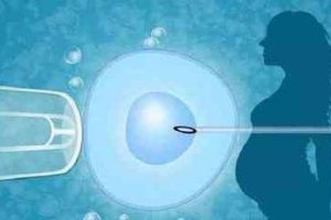 精子畸形率对生殖的影响