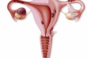 为什么越来越多人生不出孩子？这5点一定要注意！