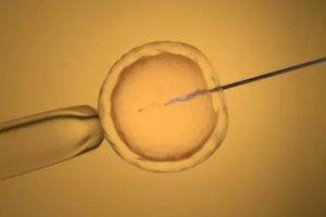 做中山试管婴儿会导致早衰吗？中山试管婴儿促排会造成女性发胖吗？如何提升中山试管婴儿的成功率？